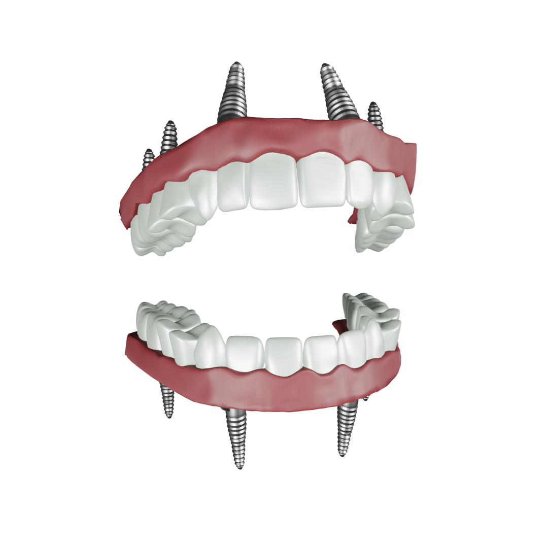 Lower jaw
